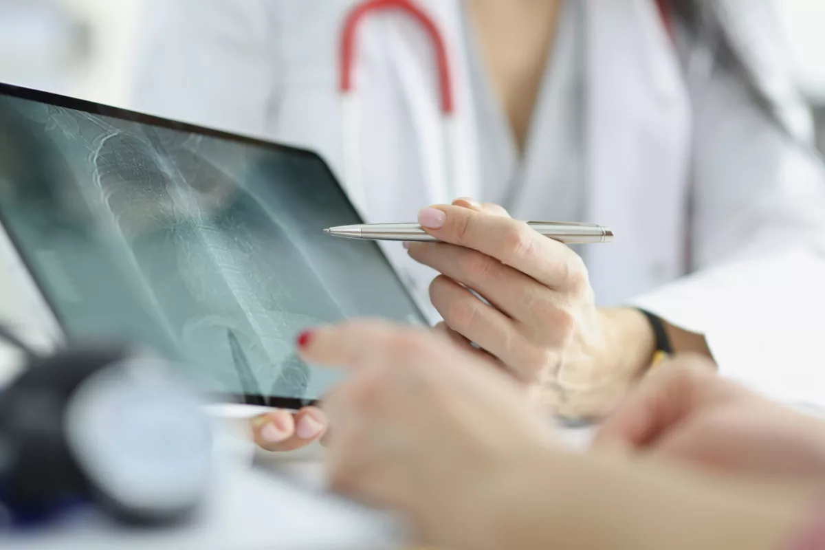 Lung-x-ray